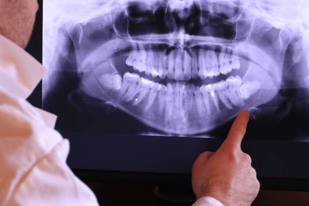 Best Broken Tooth Emergency  in Bushyhead, OK