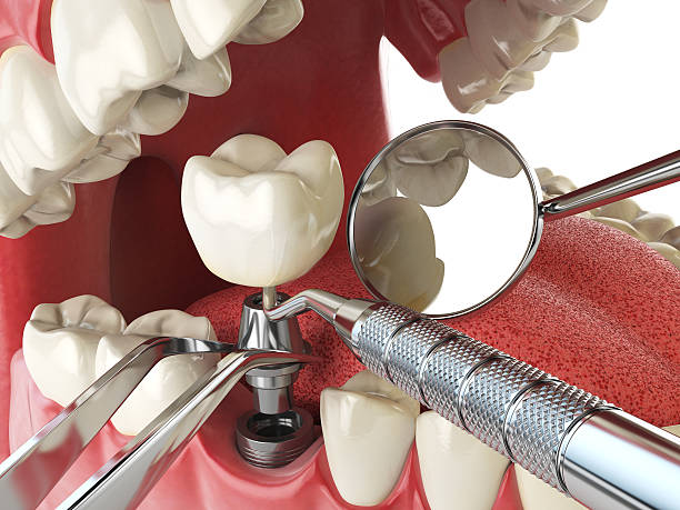 Emergency Dentist for Kids in OK
