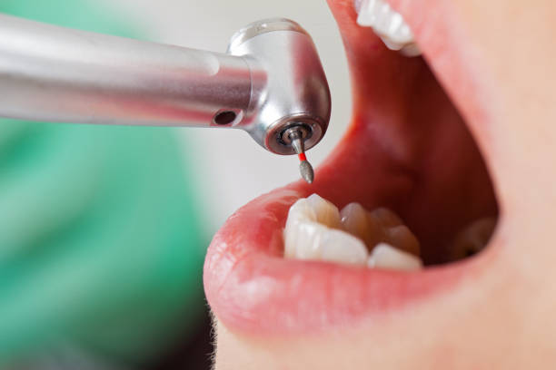 Best Root Canal Emergency Dentist  in Bushyhead, OK